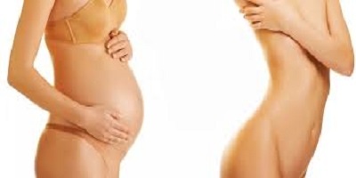 Quand faire une abdominoplastie après un accouchement ?